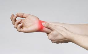 Carpal tunnel syndrome (CTS)